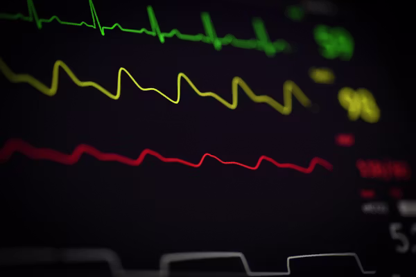 ECG & Holter Monitoring